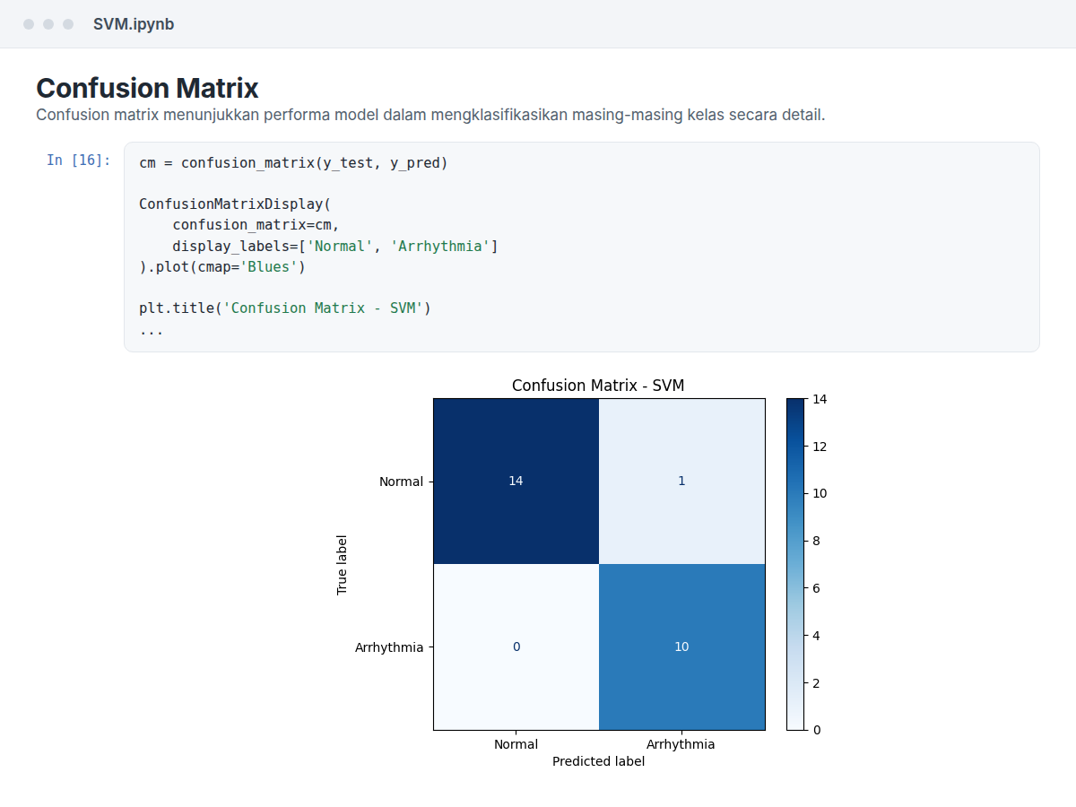 Confusion matrix for the SVM model